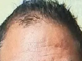 Repeat murderer’s acid trail ends at gallows | Surat News